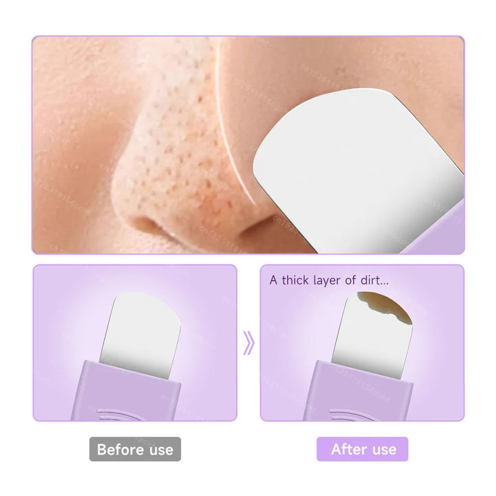 Silicone Facial Cleansing & Blackhead Removal Tool