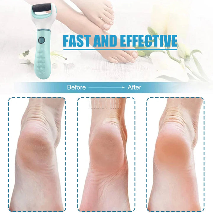 Waterproof Electric Foot Callus Remover