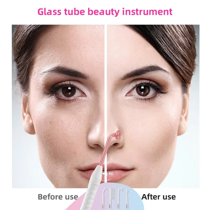 High Frequency Facial Device with 4 Electrodes