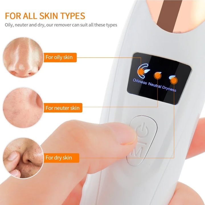 Facial Vacuum Blackhead & Pore Cleaner