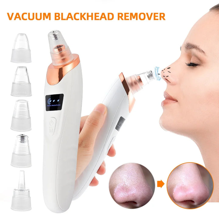 Facial Vacuum Blackhead & Pore Cleaner