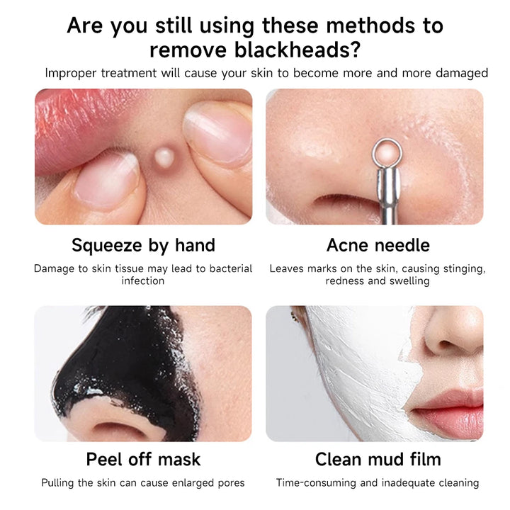 Silicone Facial Cleansing & Blackhead Removal Tool