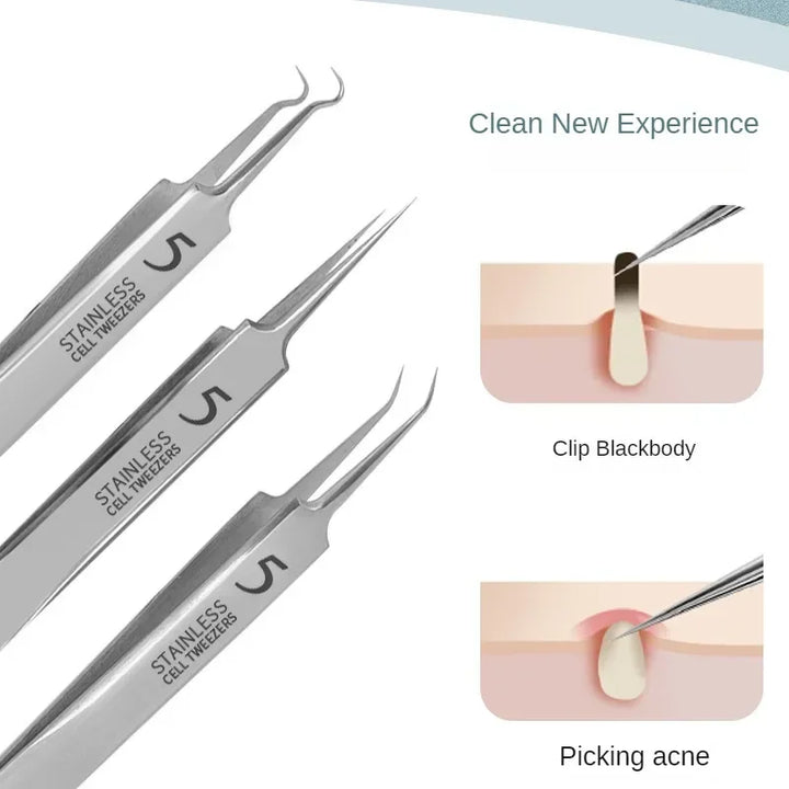 Stainless Steel Blackhead & Acne Extractor Set