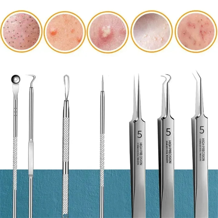 Stainless Steel Blackhead & Acne Extractor Set